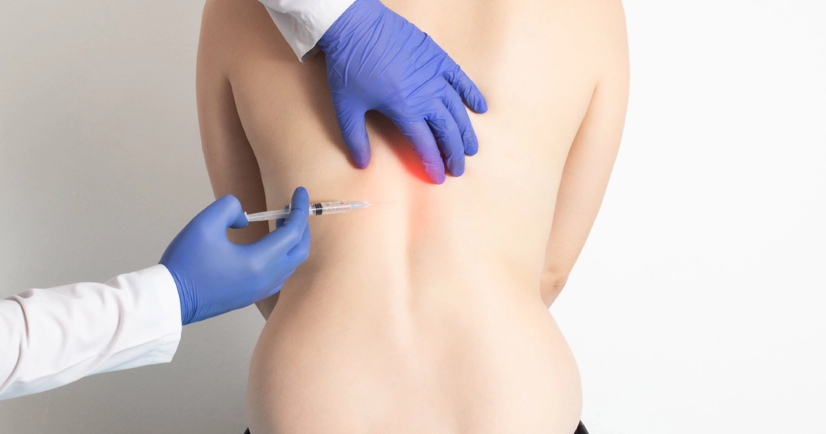 Doctor administering facet joint injections in Sandy, UT to a patient, targeting spinal joints for back and neck pain relief