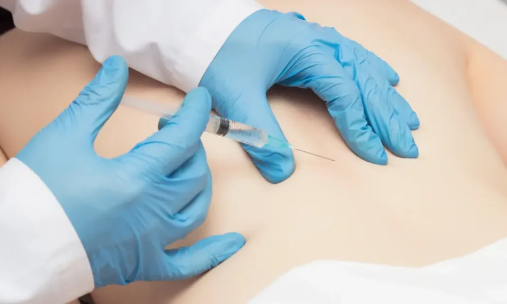 Doctor administering a caudal epidural steroid injection into a patient's lower back in Sandy, UT