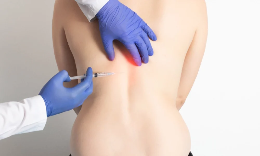 Doctor administering facet joint injections in Sandy, UT to a patient, targeting spinal joints for back and neck pain relief